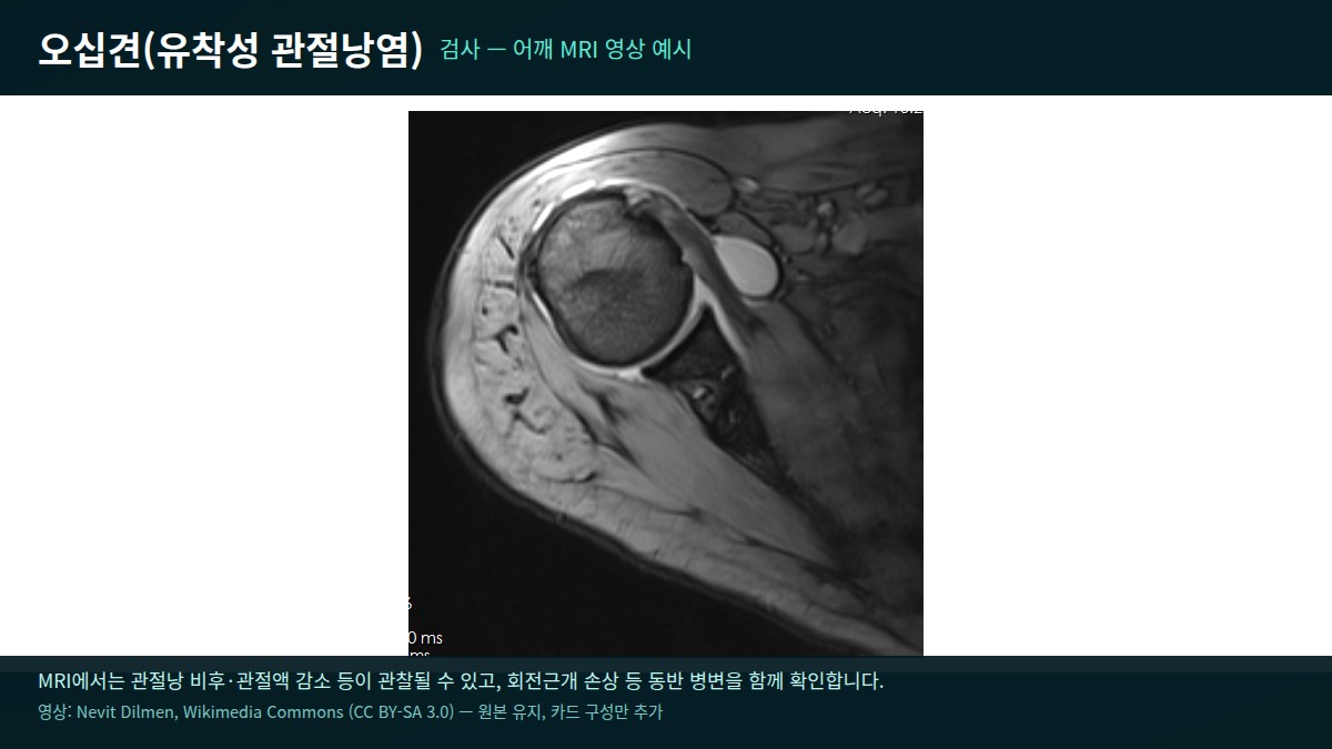 어깨 MRI 검사 영상