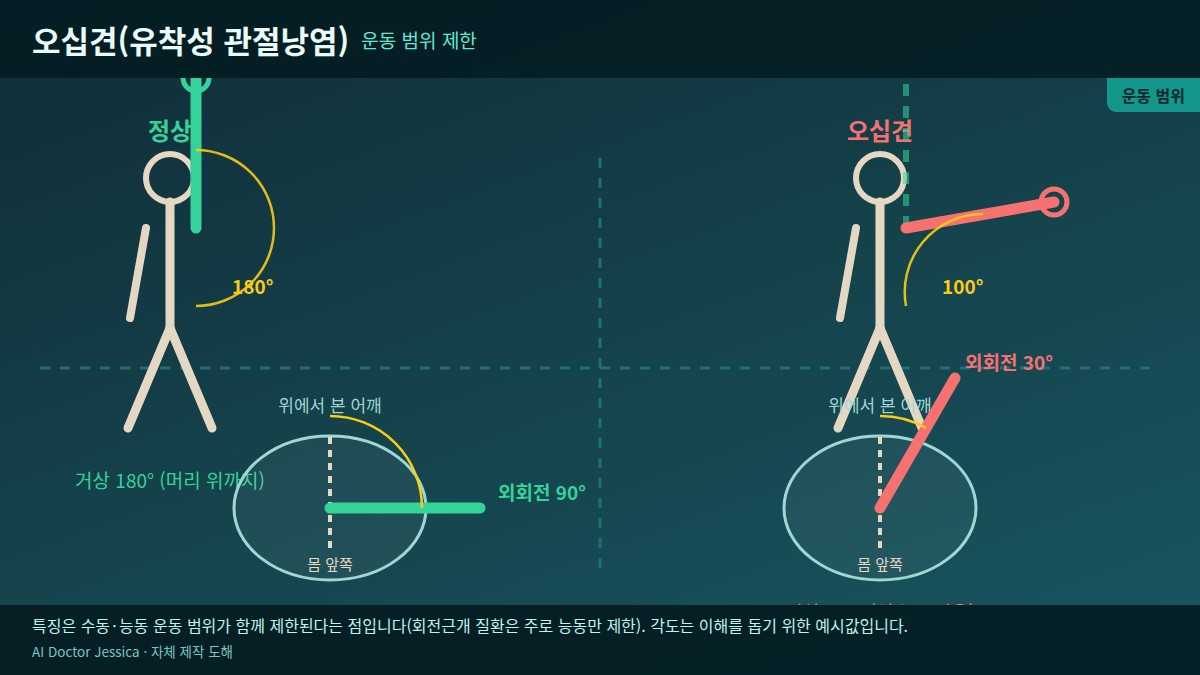 정상과 오십견의 운동 범위 비교