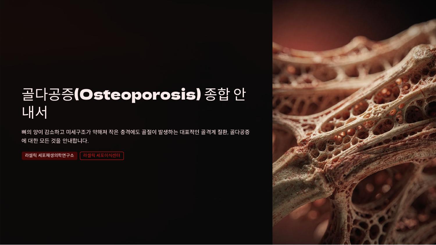 골다공증(Osteoporosis) 종합 안