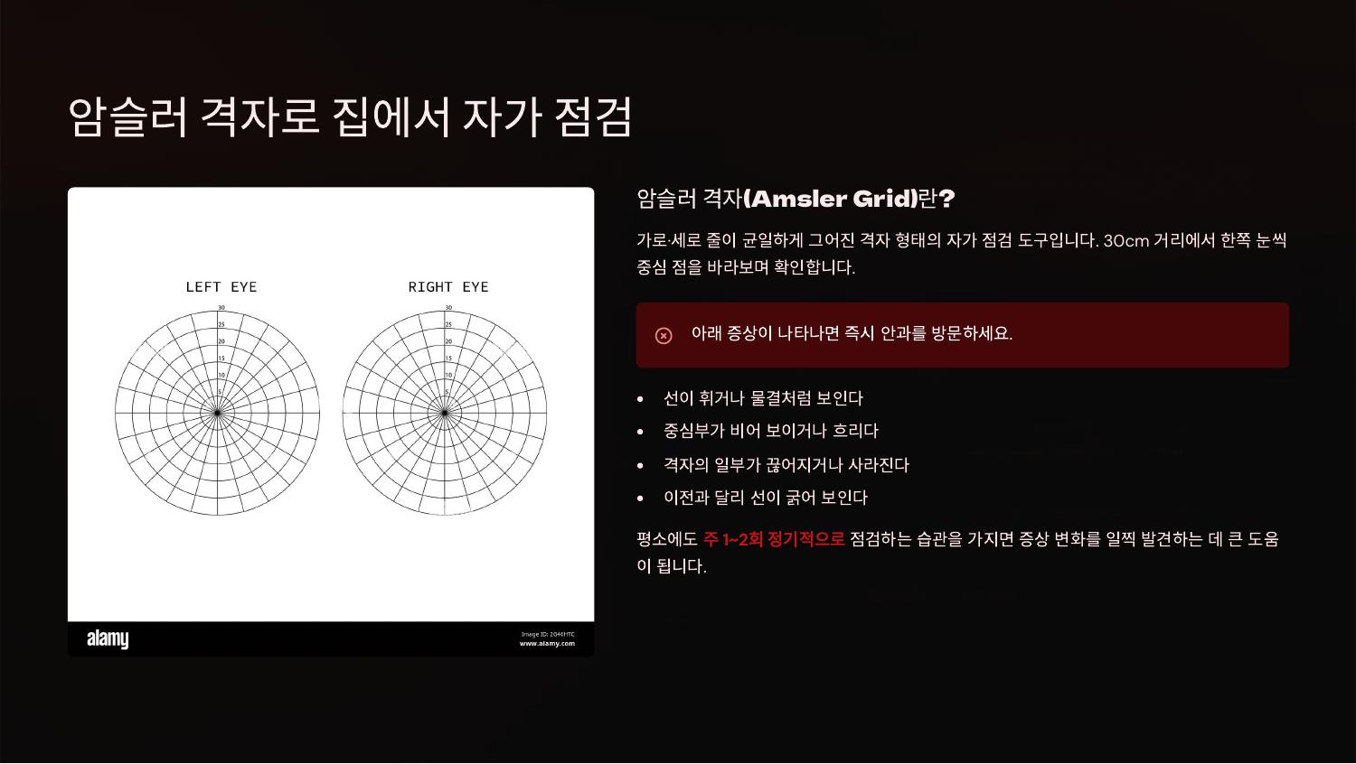 암슬러 격자로 집에서 자가 점검