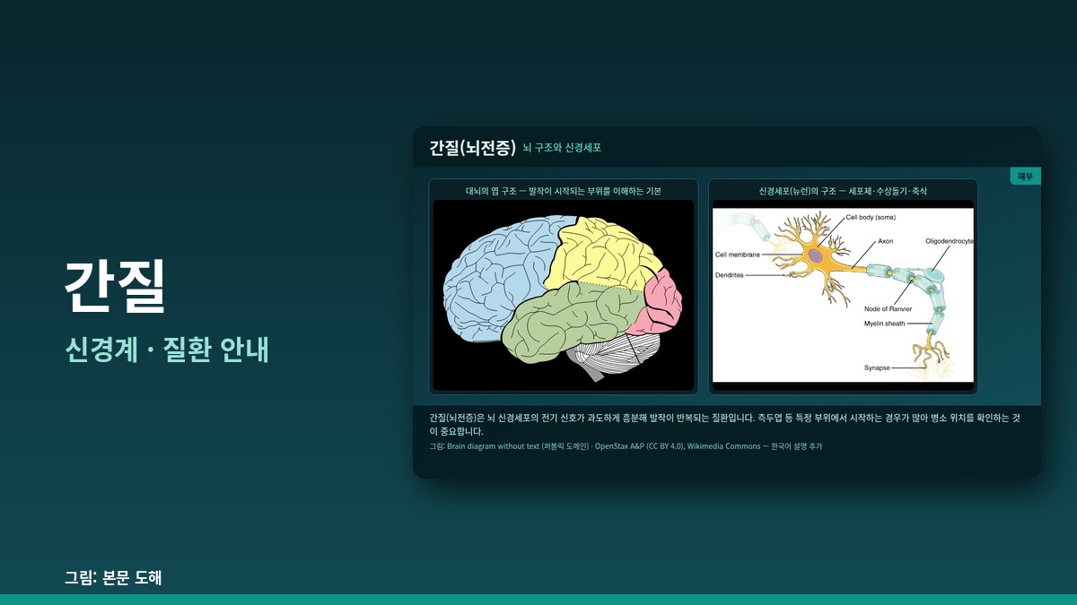 간질 — 신경계