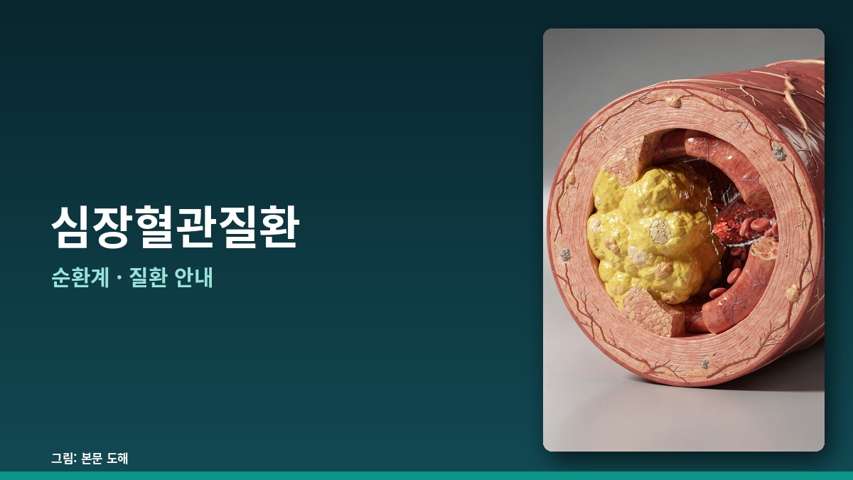 심장혈관질환 — 순환계