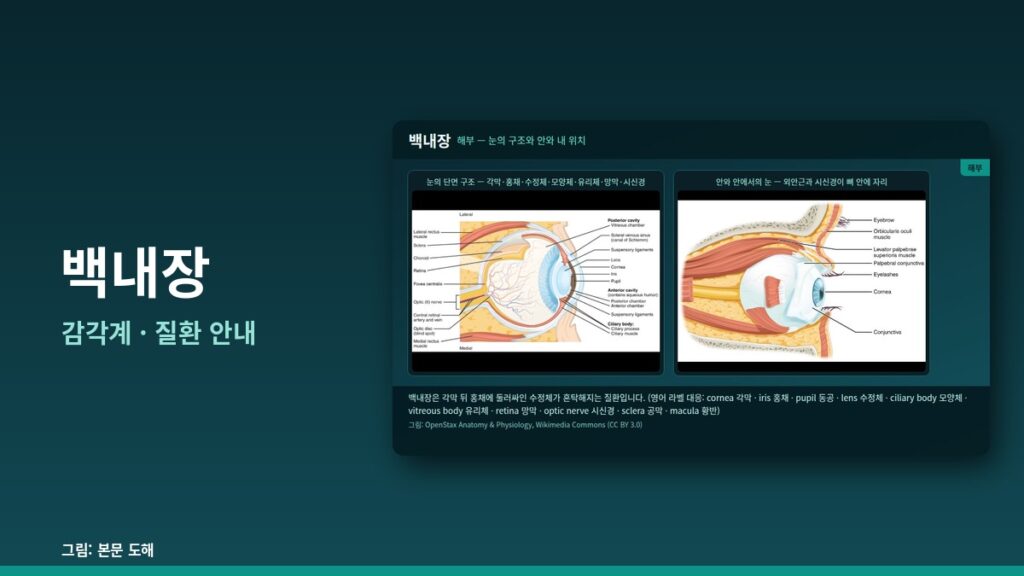 백내장(Cataract) 완전 가이드