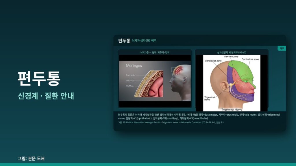 편두통 — 신경계
