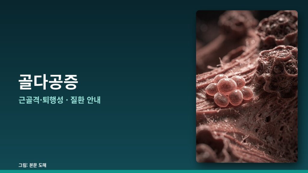 골다공증 — 근골격·퇴행성