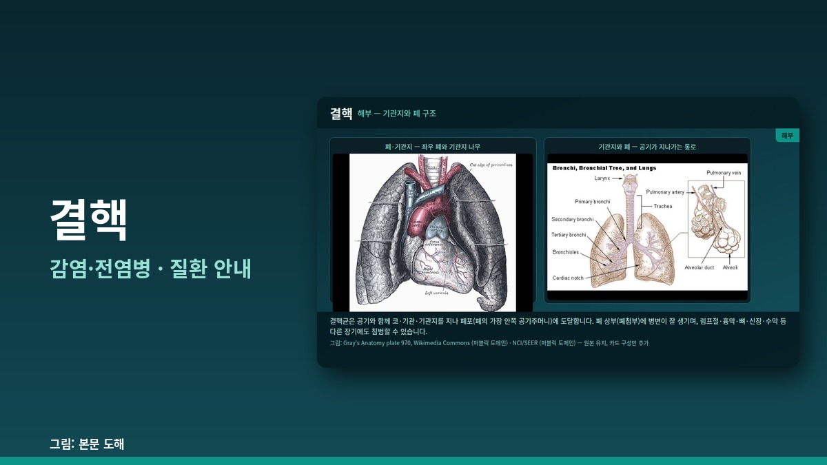 결핵 — 감염·전염병