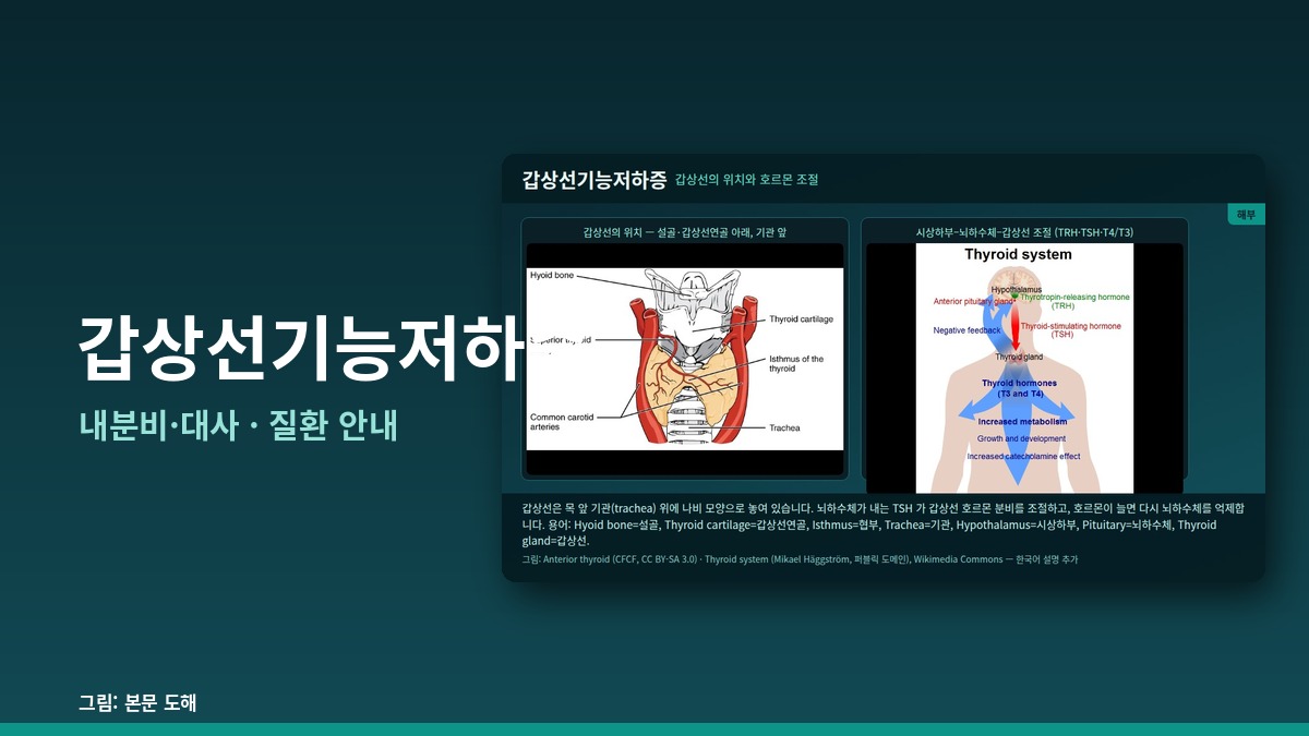 갑상선기능저하증 — 내분비·대사